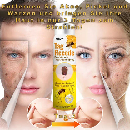 🐝BeeVital™ (UP)| Tratamiento en aerosol para Verrugas, lunares y manchas| base de veneno de abeja (UP)