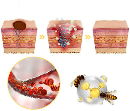 🐝BeeVital™ (UP)| Tratamiento en aerosol para Verrugas, lunares y manchas| base de veneno de abeja (UP)